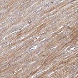 Invitrogen URG4 Polyclonal Antibody 100 &mu;L; Unconjugated:Antibodies,