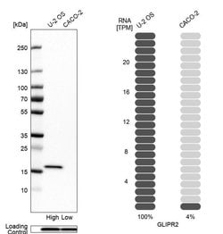 Invitrogen GLIPR2 Polyclonal Antibody 100 &mu;L; Unconjugated:Antibodies,