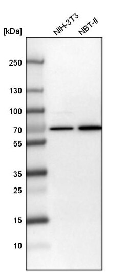 Invitrogen Transketolase Polyclonal Antibody 100 &mu;L | Buy Online | Invitrogen&trade; | Fisher Scientific