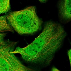 Invitrogen KLHL7 Polyclonal Antibody 100 &mu;L; Unconjugated:Antibodies,