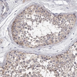 Invitrogen KLHL7 Polyclonal Antibody 100 &mu;L; Unconjugated:Antibodies,