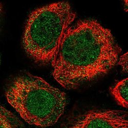 Invitrogen KLHL7 Polyclonal Antibody 100 &mu;L; Unconjugated:Antibodies,