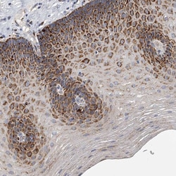 Invitrogen KLHL7 Polyclonal Antibody 100 &mu;L; Unconjugated:Antibodies,