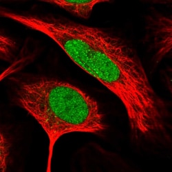 Invitrogen RFC2 Polyclonal Antibody 100 &mu;L; Unconjugated:Antibodies,