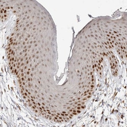 Invitrogen RFC2 Polyclonal Antibody 100 &mu;L; Unconjugated:Antibodies,