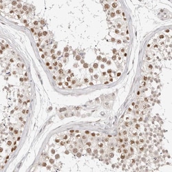Invitrogen RFC2 Polyclonal Antibody 100 &mu;L; Unconjugated:Antibodies,
