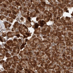 Invitrogen LRGUK Polyclonal Antibody 100 &mu;L | Buy Online | Invitrogen&trade; | Fisher Scientific