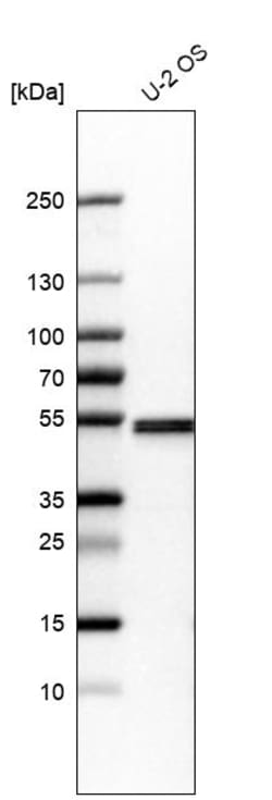 Invitrogen Septin-7 Polyclonal Antibody 100 &mu;L | Buy Online | Invitrogen&trade; | Fisher Scientific