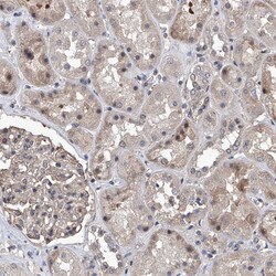 Invitrogen ZNF655 Polyclonal Antibody 100 &mu;L; Unconjugated:Antibodies,