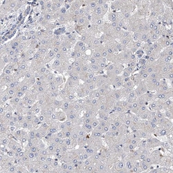 Invitrogen ZNF655 Polyclonal Antibody 100 &mu;L; Unconjugated:Antibodies,