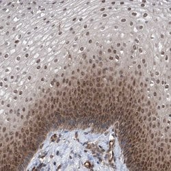 Invitrogen ZNF655 Polyclonal Antibody 100 &mu;L; Unconjugated:Antibodies,