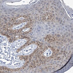 Invitrogen IMPA2 Polyclonal Antibody 100 &mu;L; Unconjugated:Antibodies,