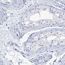 Invitrogen IMPA2 Polyclonal Antibody 100 &mu;L; Unconjugated:Antibodies,