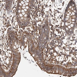Invitrogen DENND6B Polyclonal Antibody 100 &mu;L; Unconjugated:Antibodies,