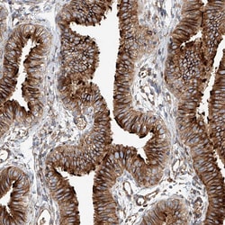 Invitrogen HGSNAT Polyclonal Antibody 100 &mu;L; Unconjugated:Antibodies,