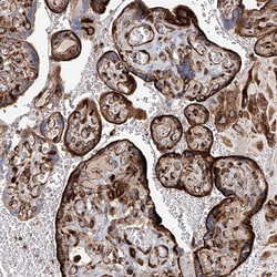 Invitrogen HGSNAT Polyclonal Antibody 100 &mu;L; Unconjugated:Antibodies,
