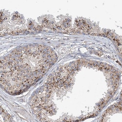 Invitrogen HGSNAT Polyclonal Antibody 100 &mu;L; Unconjugated:Antibodies,