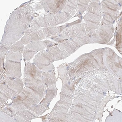Invitrogen HGSNAT Polyclonal Antibody 100 &mu;L; Unconjugated:Antibodies,