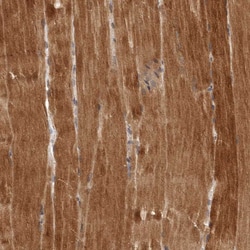 Invitrogen QRSL1 Polyclonal Antibody 100 &mu;L; Unconjugated:Antibodies,