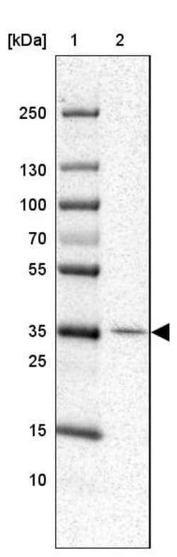 Invitrogen RNF217 Polyclonal Antibody 100 &mu;L; Unconjugated:Antibodies,