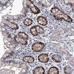 Invitrogen USP45 Polyclonal Antibody 100 &mu;L; Unconjugated:Antibodies,