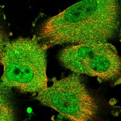 Invitrogen CHML Polyclonal Antibody 100 &mu;L; Unconjugated:Antibodies,