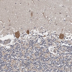 Invitrogen CHML Polyclonal Antibody 100 &mu;L; Unconjugated:Antibodies,