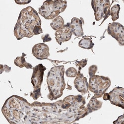 Invitrogen CHML Polyclonal Antibody 100 &mu;L; Unconjugated:Antibodies,