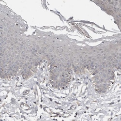 Invitrogen CHML Polyclonal Antibody 100 &mu;L; Unconjugated:Antibodies,