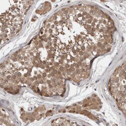 Invitrogen CHML Polyclonal Antibody 100 &mu;L; Unconjugated:Antibodies,