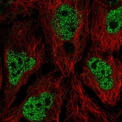 Invitrogen AIM1L Polyclonal Antibody 100 &mu;L; Unconjugated:Antibodies,
