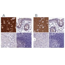 Invitrogen SNAP91 Polyclonal Antibody 100 &mu;L; Unconjugated:Antibodies,