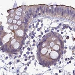 Invitrogen SNAP91 Polyclonal Antibody 100 &mu;L; Unconjugated:Antibodies,