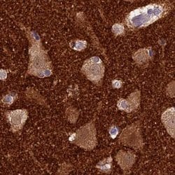 Invitrogen SNAP91 Polyclonal Antibody 100 &mu;L; Unconjugated:Antibodies,