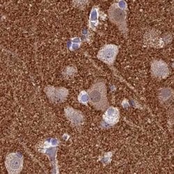Invitrogen SNAP91 Polyclonal Antibody 100 &mu;L; Unconjugated:Antibodies,