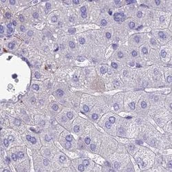 Invitrogen SNAP91 Polyclonal Antibody 100 &mu;L; Unconjugated:Antibodies,
