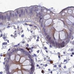 Invitrogen SNAP91 Polyclonal Antibody 100 &mu;L; Unconjugated:Antibodies,