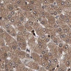 Invitrogen PSMB1 Polyclonal Antibody 100 &mu;L; Unconjugated:Antibodies,