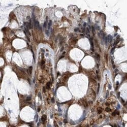 Invitrogen PSMB1 Polyclonal Antibody 100 &mu;L; Unconjugated:Antibodies,
