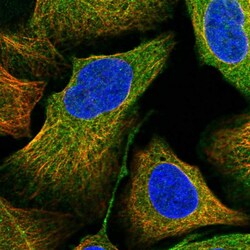 Invitrogen ANKRD34A Polyclonal Antibody 100 &mu;L; Unconjugated:Antibodies,