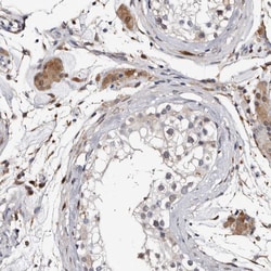 Invitrogen RCL Polyclonal Antibody 100 &mu;L; Unconjugated:Antibodies,