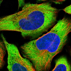 Invitrogen PDSS2 Polyclonal Antibody 100 &mu;L; Unconjugated:Antibodies,