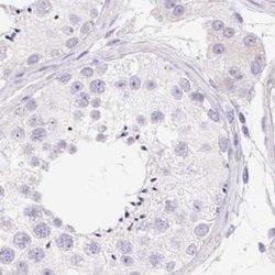 Invitrogen KCNE2 Polyclonal Antibody 100 &mu;L; Unconjugated:Antibodies,