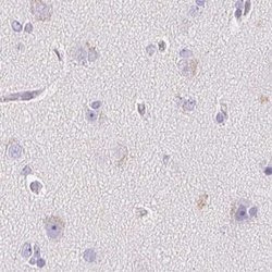 Invitrogen KCNE2 Polyclonal Antibody 100 &mu;L; Unconjugated:Antibodies,