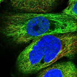 Invitrogen MAP7 Polyclonal Antibody 100 &mu;L; Unconjugated:Antibodies,