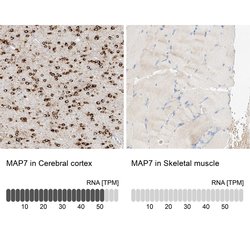 Invitrogen MAP7 Polyclonal Antibody 100 &mu;L; Unconjugated:Antibodies,