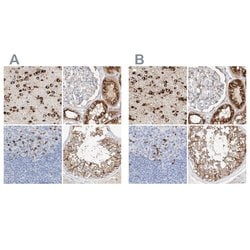 Invitrogen MAP7 Polyclonal Antibody 100 &mu;L; Unconjugated:Antibodies,