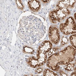 Invitrogen MAP7 Polyclonal Antibody 100 &mu;L; Unconjugated:Antibodies,