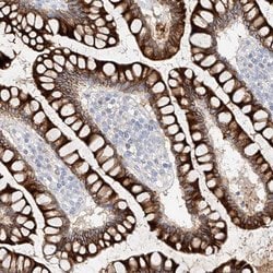 Invitrogen MAP7 Polyclonal Antibody 100 &mu;L; Unconjugated:Antibodies,