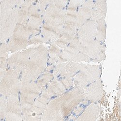 Invitrogen MAP7 Polyclonal Antibody 100 &mu;L; Unconjugated:Antibodies,
